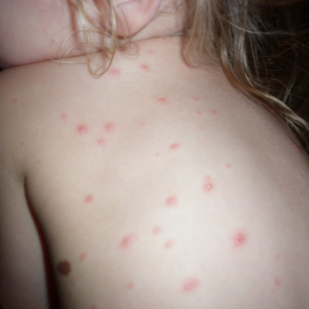 child unusual rash